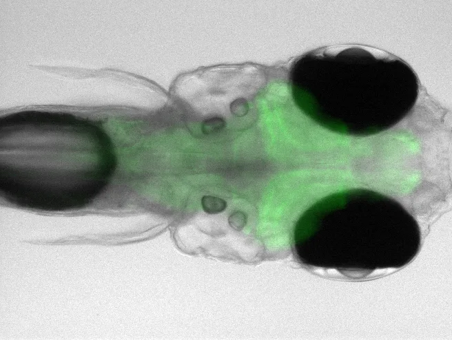 Whole-brain fluorescence image of a larval zebrafish
